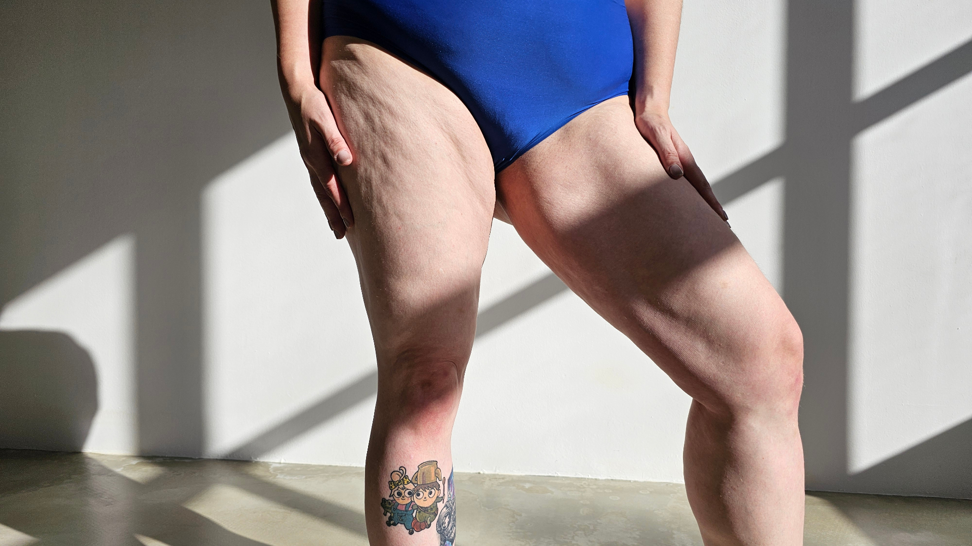 Meine ehrliche Bilanz – 10 Jahre nach Liposuktion